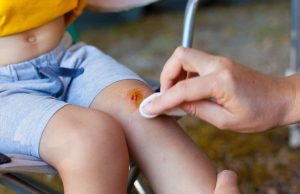 Як захиститись від правця: рекомендації лікаря епідеміолога Як-захиститись-від-правця:-рекомендації-лікаря-епідеміолога