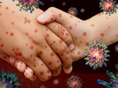 Як уникнути захворювання кором Як-уникнути-захворювання-кором