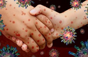 Як уникнути захворювання кором Як-уникнути-захворювання-кором