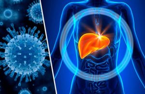 Гепатит А: симптоми та рекомендації як вберегтися Гепатит-А:-симптоми-та-рекомендації-як-вберегтися