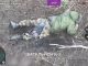 У пораненого окупанта димить нижче спини. ВIДЕО 18+ У-пораненого-окупанта-димить-нижче-спини.-ВiДЕО-18+