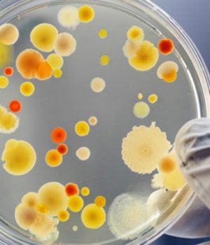 Ротавірусна-інфекція:-симптоми-та-профілактика Ротавірусна-інфекція:-симптоми-та-профілактика