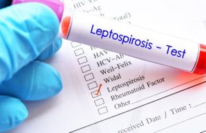 Профілактика лептоспірозу Профілактика-лептоспірозу