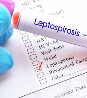 Профілактика-лептоспірозу