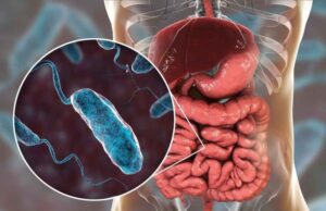 Що потрібно знати про холеру Що-потрібно-знати-про-холеру