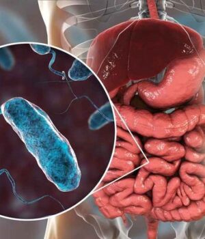 Що-потрібно-знати-про-холеру Що-потрібно-знати-про-холеру