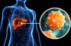 Вірусні гепатити В та С: особливості та профілактика Вірусні-гепатити-В-та-С:-особливості-та-профілактика