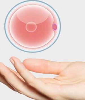 Чому-жінки-вирішують-стати-донорами-яйцеклітин Чому-жінки-вирішують-стати-донорами-яйцеклітин