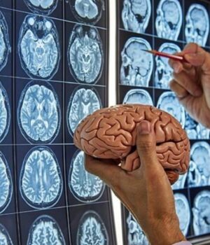 Вчені-зʼясували,-що-мозок-має-пʼять-фаз-розвитку-–-дорослішання-починається-у-32-роки Вчені-зʼясували,-що-мозок-має-пʼять-фаз-розвитку-–-дорослішання-починається-у-32-роки