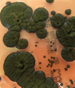 "Чорний-грибок"-із-Чорнобиля-може-захистити-астронавтів-від-радіації-–-вчені