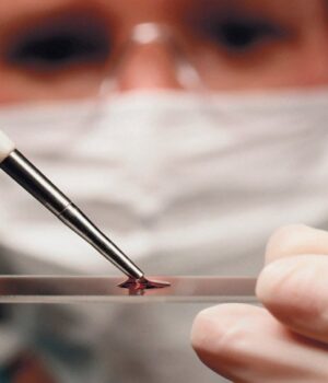 Епідеміологи-заперечили,-що-40-річна-волинянка-у-Львові-померла-від-сказу Епідеміологи-заперечили,-що-40-річна-волинянка-у-Львові-померла-від-сказу