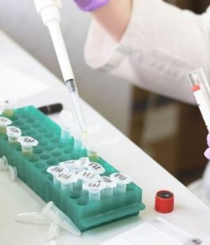 Яка-група-крові-підвищує-ризик-раннього-інсульту —-що з’ясували-генетики Яка-група-крові-підвищує-ризик-раннього-інсульту —-що з’ясували-генетики