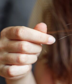 Волосся-заповнило-третину-шлунка:-у-Луцьку-лікарі-врятували-7-річну-дівчинку Волосся-заповнило-третину-шлунка:-у-Луцьку-лікарі-врятували-7-річну-дівчинку