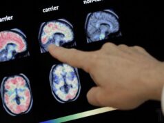 Руйнують мозок і пам’ять: учені назвали щоденні звички, які вбивають інтелект Руйнують-мозок-і-пам’ять:-учені-назвали-щоденні-звички,-які-вбивають-інтелект