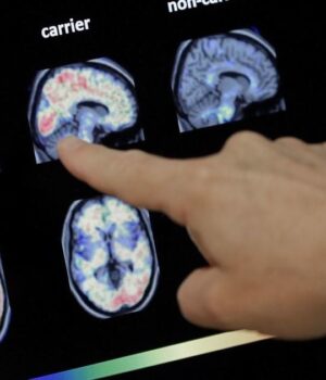 Руйнують-мозок-і-пам’ять:-учені-назвали-щоденні-звички,-які-вбивають-інтелект