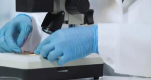 Лікарі б’ють на сполох: смертоносний грибок стає заразнішим і поширюється світом Лікарі-б’ють-на-сполох:-смертоносний-грибок-стає-заразнішим-і-поширюється-світом