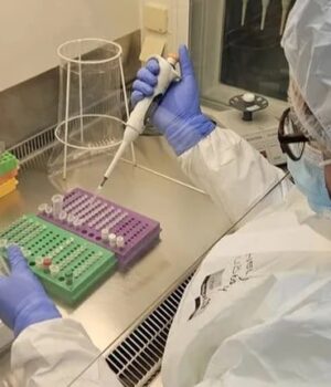 Коли-люди-почали-хворіти-на-герпес?-Науковці-знайшли-докази-віком-2,5-тисячі-років