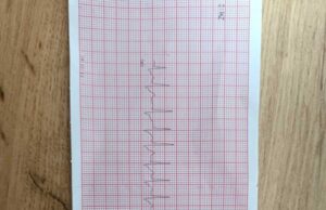 На Волині медики повернули до життя чоловіка, який вдавився На-Волині-медики-повернули-до-життя-чоловіка,-який-вдавився