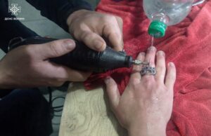 На Волині рятувальники допомогли зняти каблучку 17-річному хлопцю На-Волині-рятувальники-допомогли-зняти-каблучку-17-річному-хлопцю