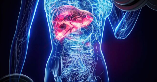 Що треба їсти для здоров’я печінки: три корисні продукти Що-треба-їсти-для-здоров’я-печінки:-три-корисні-продукти