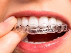 Як та навіщо носити елайнери: дбаємо про прикус Як-та-навіщо-носити-елайнери:-дбаємо-про-прикус