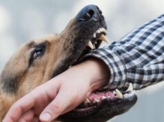 Скільки лучан постраждало від укусів тварин з початку 2026 року Скільки-лучан-постраждало-від-укусів-тварин-з-початку-2026-року