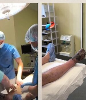 На-Волині-чоловіку-ампутували-ногу-після-обмороження На-Волині-чоловіку-ампутували-ногу-після-обмороження