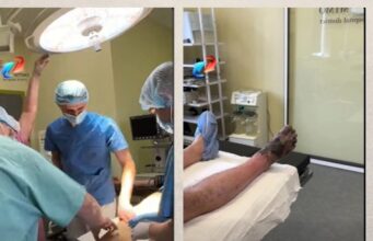 На Волині чоловіку ампутували ногу після обмороження На-Волині-чоловіку-ампутували-ногу-після-обмороження