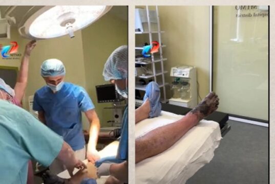 На Волині чоловіку ампутували ногу після обмороження На-Волині-чоловіку-ампутували-ногу-після-обмороження