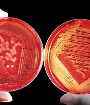 Стародавні-бактерії-з-крижаної-печери-в-Румунії-виявилися-стійкими-до-10-антибіотиків