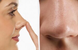 Ваш ніс – дрібниця: у одного чоловіка він був довший за олівець Ваш-ніс-–-дрібниця:-у-одного-чоловіка-він-був-довший-за-олівець