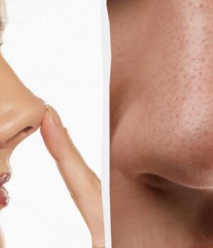 Ваш-ніс-–-дрібниця:-у-одного-чоловіка-він-був-довший-за-олівець Ваш-ніс-–-дрібниця:-у-одного-чоловіка-він-був-довший-за-олівець