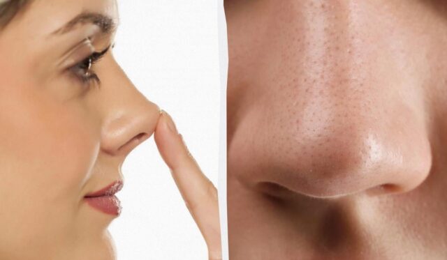 Ваш ніс – дрібниця: у одного чоловіка він був довший за олівець Ваш-ніс-–-дрібниця:-у-одного-чоловіка-він-був-довший-за-олівець