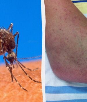 Небезпечна-тропічна-інфекція-загрожує-майже-всій-Європі,-–-the-guardian