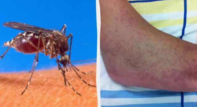 Небезпечна тропічна інфекція загрожує майже всій Європі, – The Guardian Небезпечна-тропічна-інфекція-загрожує-майже-всій-Європі,-–-the-guardian