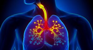 Туберкульоз: факти, симптоми та профілактика Туберкульоз:-що-потрібно-знати-кожному