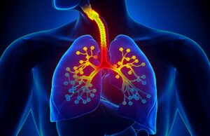 Туберкульоз: факти, симптоми та профілактика Туберкульоз:-що-потрібно-знати-кожному