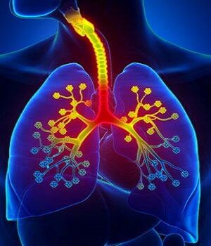 Туберкульоз:-що-потрібно-знати-кожному