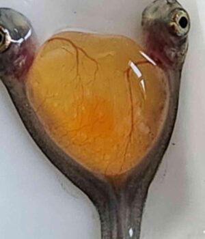 Дві-голови-і-одне-тіло:-вчені-випадково-знайшли-рідкісних-сіамських-близнюків