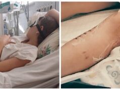 Довелось ампутувати ногу: собака напав на дівчинку на Дніпропетровщині (фото) Довелось-ампутувати-ногу:-собака-напав-на дівчинку-на Дніпропетровщині-(фото)