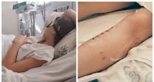 Довелось ампутувати ногу: собака напав на дівчинку на Дніпропетровщині (фото) Довелось-ампутувати-ногу:-собака-напав-на дівчинку-на Дніпропетровщині-(фото)