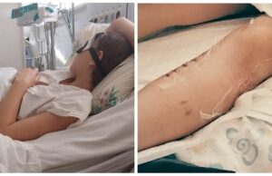 Довелось ампутувати ногу: собака напав на дівчинку на Дніпропетровщині (фото) Довелось-ампутувати-ногу:-собака-напав-на дівчинку-на Дніпропетровщині-(фото)