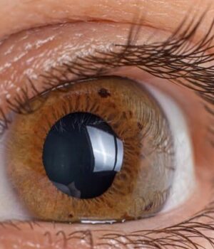 В-Іспанії-з-луски-риб-створили-штучну-рогівку-ока:-вона-може-стати-альтернативою-донорської В-Іспанії-з-луски-риб-створили-штучну-рогівку-ока:-вона-може-стати-альтернативою-донорської