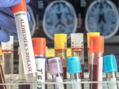 Аналіз крові може передбачити ризик деменції у жінок за десятки років до появи симптомів, –... Аналіз-крові-може-передбачити-ризик-деменції-у-жінок-за-десятки-років-до-появи-симптомів,-–.