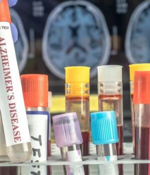 Аналіз-крові-може-передбачити-ризик-деменції-у-жінок-за-десятки-років-до-появи-симптомів,-–.