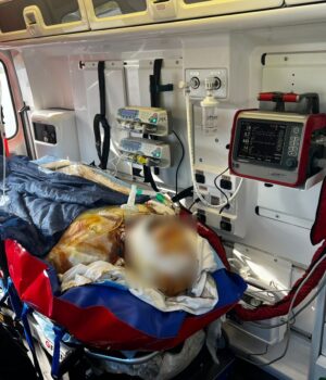 Волинські-медики-екстренки-транспортували-пацієнта-з-тяжкими-опіками