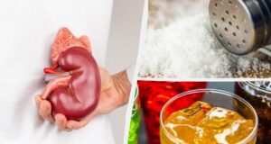 Дієтологи назвали 7 популярних продуктів, які непомітно руйнують нирки Дієтологи-назвали-7-популярних-продуктів,-які-непомітно-руйнують-нирки