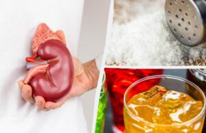 Дієтологи назвали 7 популярних продуктів, які непомітно руйнують нирки Дієтологи-назвали-7-популярних-продуктів,-які-непомітно-руйнують-нирки