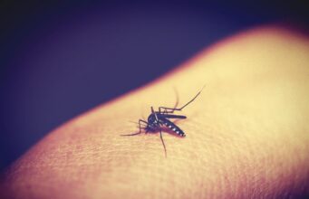 Один засіб з аптечки допоможе, якщо укус комара сильно свербить: порада дерматолога Один-засіб-з-аптечки-допоможе,-якщо-укус-комара-сильно-свербить:-порада-дерматолога