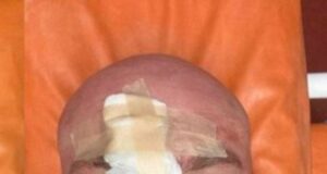 Військового ледь не вбили арматурою після прохання вимкнути російську музику: моторошні деталі (фото, відео) Військового-ледь-не вбили-арматурою-після-прохання-вимкнути-російську-музику:-моторошні-деталі-(фото,-відео)